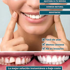 SmilePro 🦷 - Carillas Dentales Ajustables De Resina + ESTUCHE REGALO - ¡Últimas unidades!
